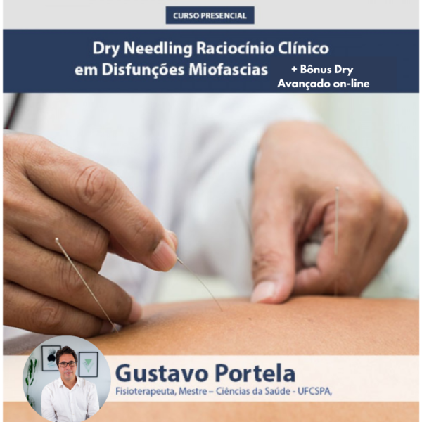 Dry Needling Raciocínio Clínico em Disfunções Miofascias 